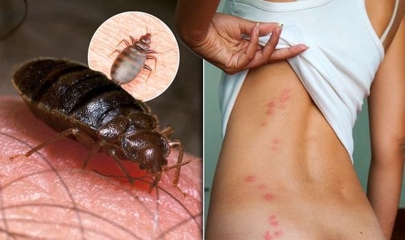 rệp giường đốt người